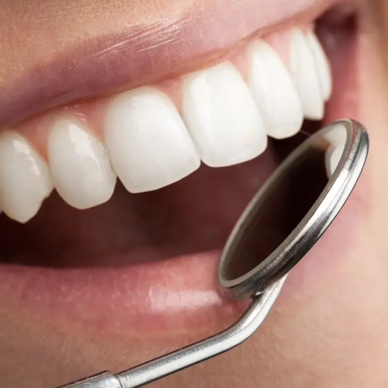controllo denti durante prima visita